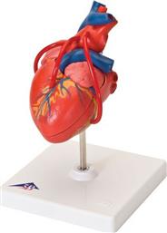 3b Scientific Πρόπλασμα Καρδιάς με Bypass
